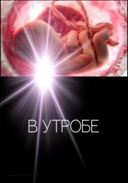   / In Utero DVO